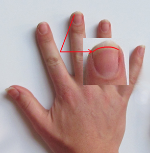 Fingernägel dicke Nagelknipser für